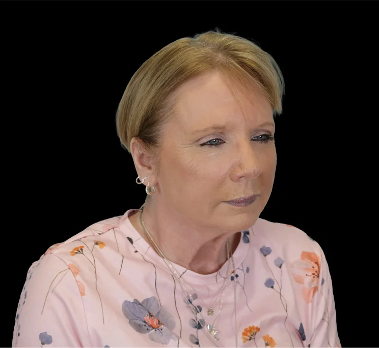 Real patient results in New York, NY Performed by Sameer Halani, MD