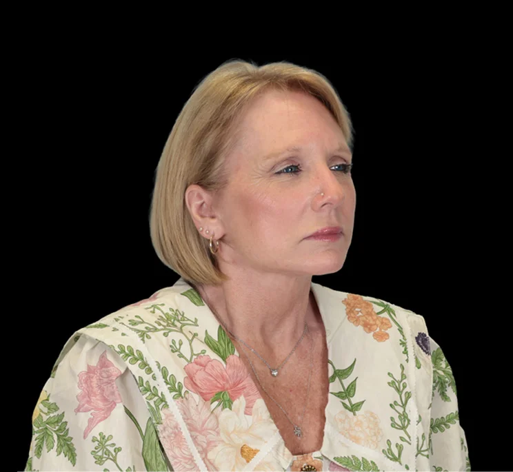 Real patient results in New York, NY Performed by Sameer Halani, MD