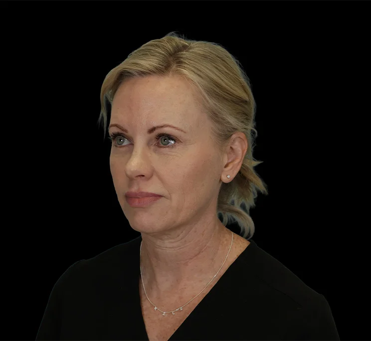 Real patient results in New York, NY Performed by Sameer Halani, MD