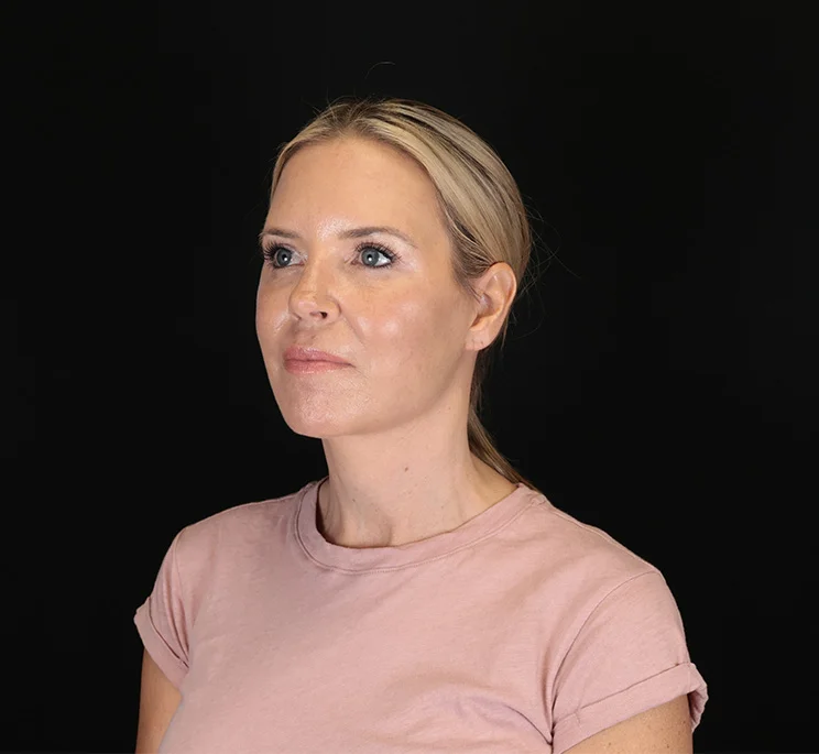 Real patient results in New York, NY Performed by Sameer Halani, MD
