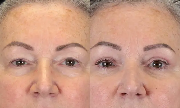 Real patient results in New York, NY Performed by Sameer Halani, MD